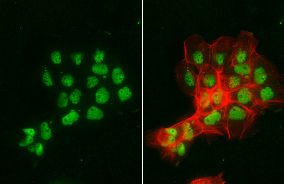 NBS1 Antibody in Immunocytochemistry (ICC/IF)