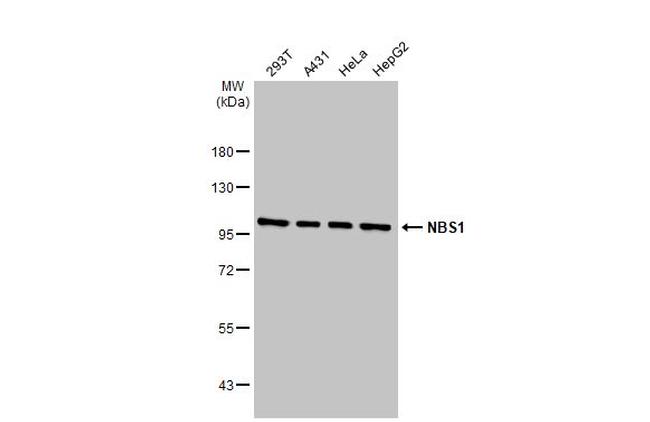 NBS1 Antibody in Western Blot (WB)