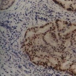 MDM2 Antibody in Immunohistochemistry (Paraffin) (IHC (P))