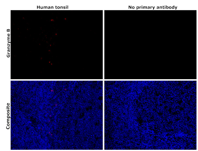 Granzyme B Antibody in Immunohistochemistry (Paraffin) (IHC (P))