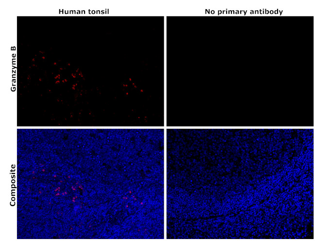 Granzyme B Antibody in Immunohistochemistry (Paraffin) (IHC (P))