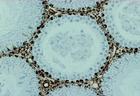 alpha Tubulin Antibody in Immunohistochemistry (IHC)