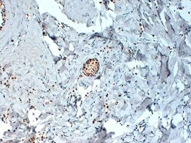 Estrogen Receptor alpha Antibody in Immunohistochemistry (Paraffin) (IHC (P))