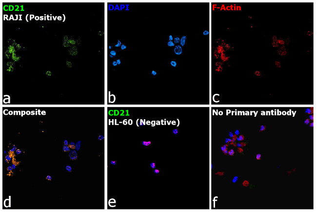 CD21 Antibody