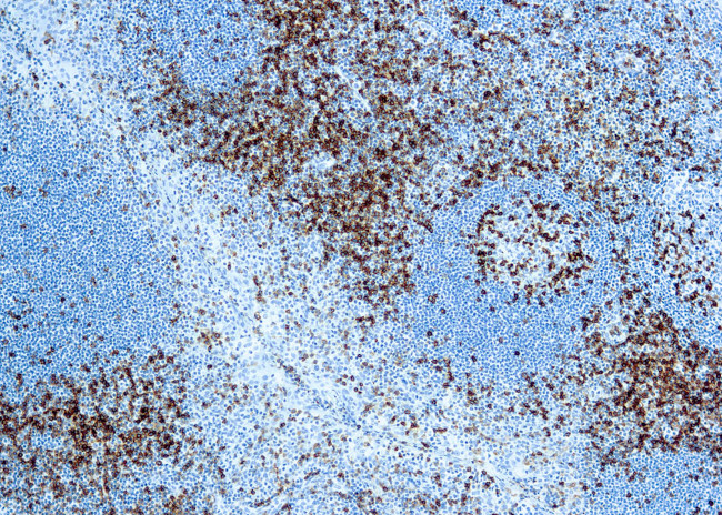 CD45RO Antibody in Immunohistochemistry (Paraffin) (IHC (P))