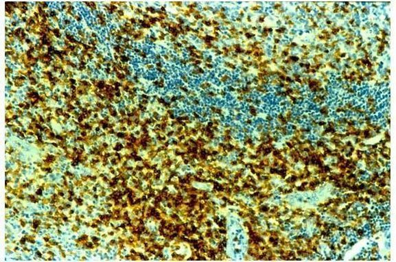 CD45RO Antibody in Immunohistochemistry (Paraffin) (IHC (P))