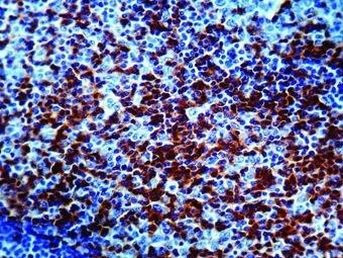 CD45RO Antibody in Immunohistochemistry (IHC)