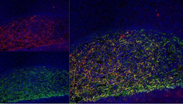 CD21 Antibody in Immunohistochemistry (Frozen) (IHC (F))