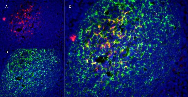 CD21 Antibody in Immunohistochemistry (Frozen) (IHC (F))