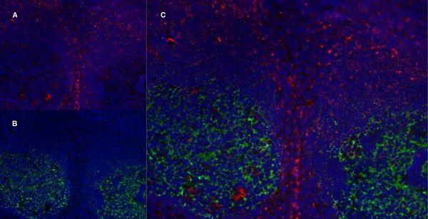 CD21 Antibody in Immunohistochemistry (Frozen) (IHC (F))