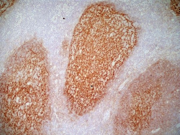 CD21 Antibody in Immunohistochemistry (Frozen) (IHC (F))