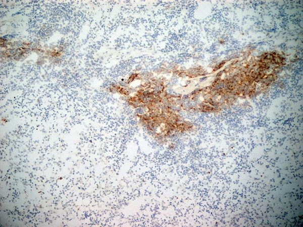 CD21 Antibody in Immunohistochemistry (Frozen) (IHC (F))