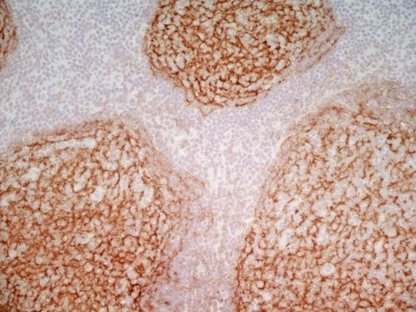 CD21 Antibody in Immunohistochemistry (Frozen) (IHC (F))