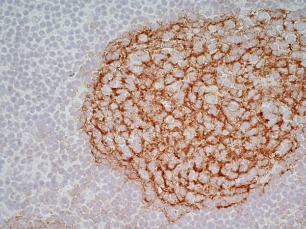 CD21 Antibody in Immunohistochemistry (Frozen) (IHC (F))