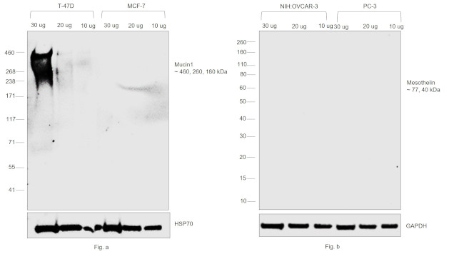 Human Kappa Light Chain Secondary Antibody