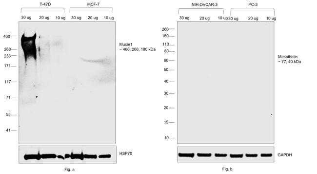 Human Kappa Light Chain Secondary Antibody in Western Blot (WB)