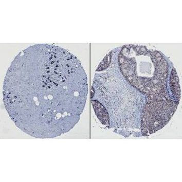 HEF1 Antibody in Immunohistochemistry (Paraffin) (IHC (P))