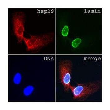 Lamin A/C Antibody in Immunocytochemistry (ICC/IF)