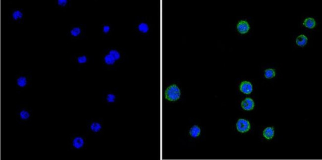 GRK1 Antibody in Immunocytochemistry (ICC/IF)