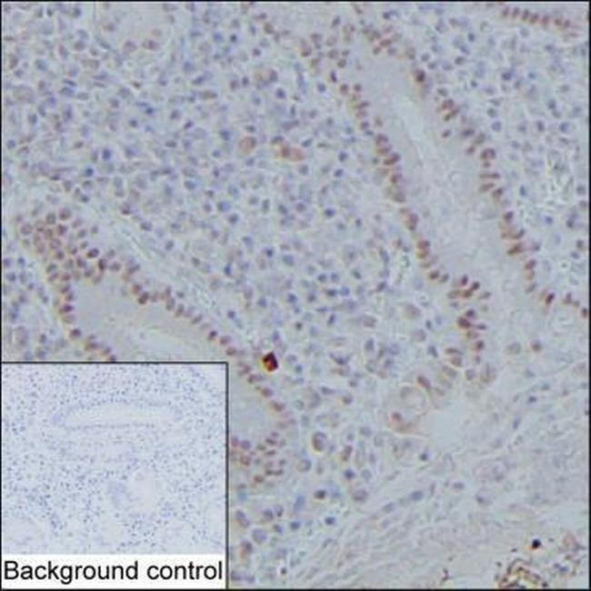 Delangin Isoform B Antibody in Immunohistochemistry (Paraffin) (IHC (P))