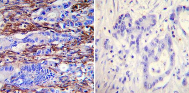 Actin Antibody in Immunohistochemistry (Paraffin) (IHC (P))