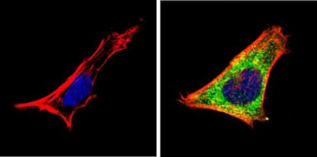 RARA Antibody in Immunocytochemistry (ICC/IF)