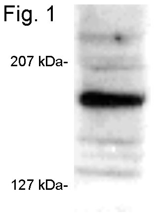 SRC3 Antibody in Western Blot (WB)