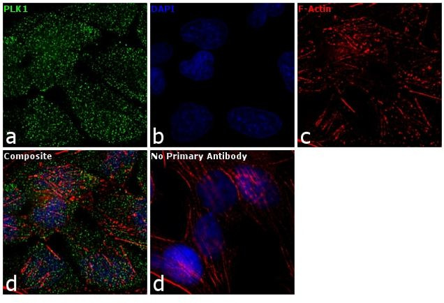 PLK1 Antibody in Immunocytochemistry (ICC/IF)