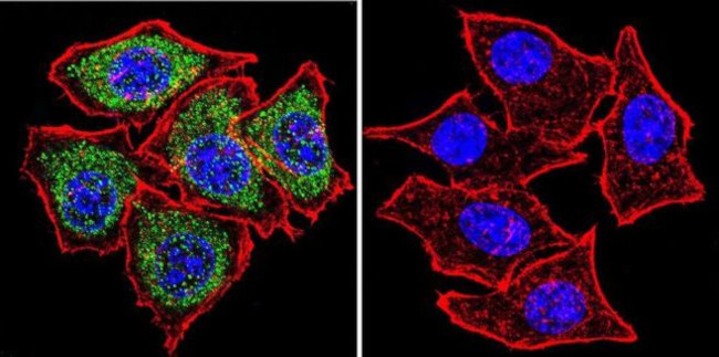 PLK1 Antibody in Immunocytochemistry (ICC/IF)