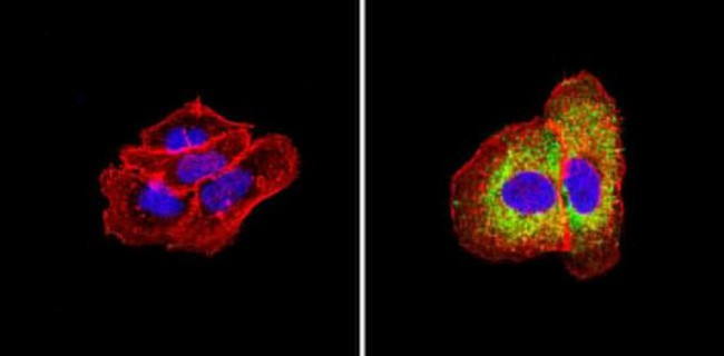 ErbB4 Antibody in Immunocytochemistry (ICC/IF)