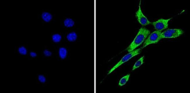 ErbB4 Antibody in Immunocytochemistry (ICC/IF)