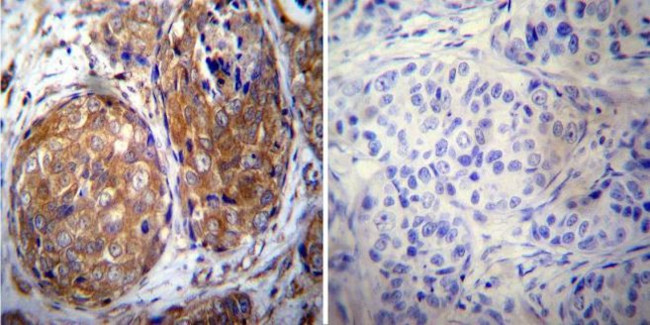 ErbB4 Antibody in Immunohistochemistry (Paraffin) (IHC (P))