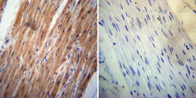 ErbB4 Antibody in Immunohistochemistry (Paraffin) (IHC (P))