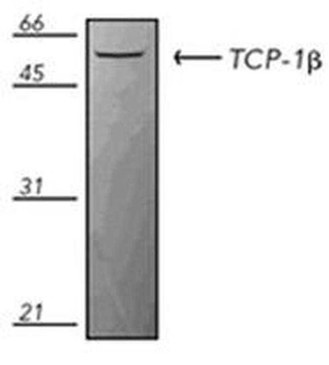 TCP-1 beta Antibody in Western Blot (WB)