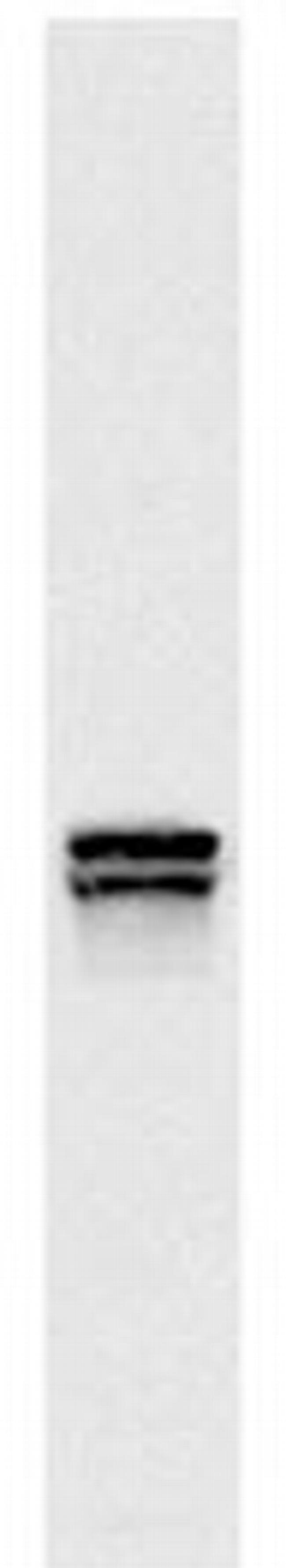 Lys20/Lys21 Antibody in Western Blot (WB)