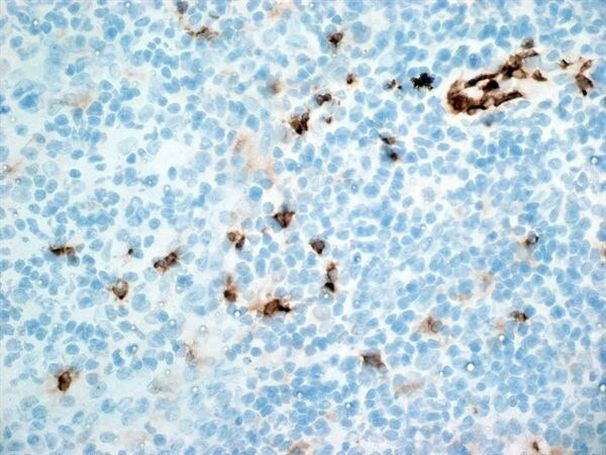 CD11b Antibody in Immunohistochemistry (Frozen) (IHC (F))