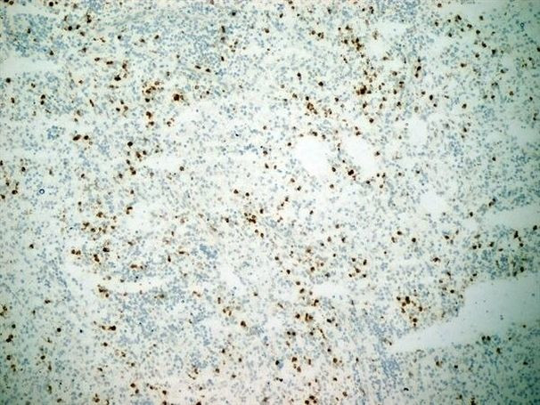 CD11b Antibody in Immunohistochemistry (Frozen) (IHC (F))