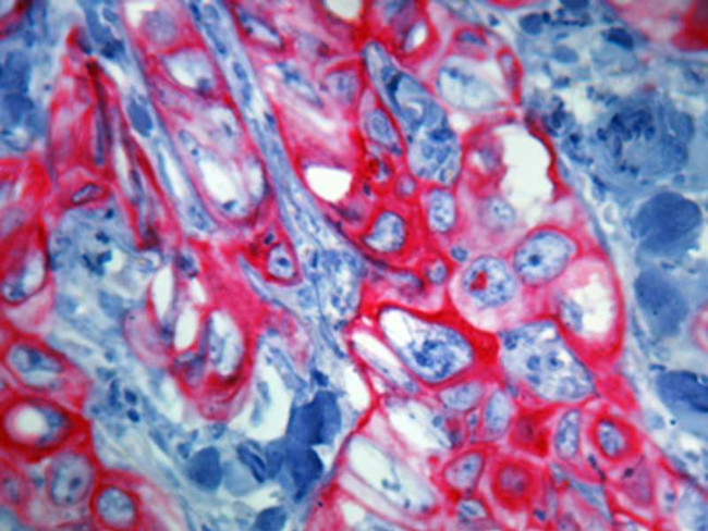 Cytokeratin 5/6 Antibody in Immunohistochemistry (Paraffin) (IHC (P))