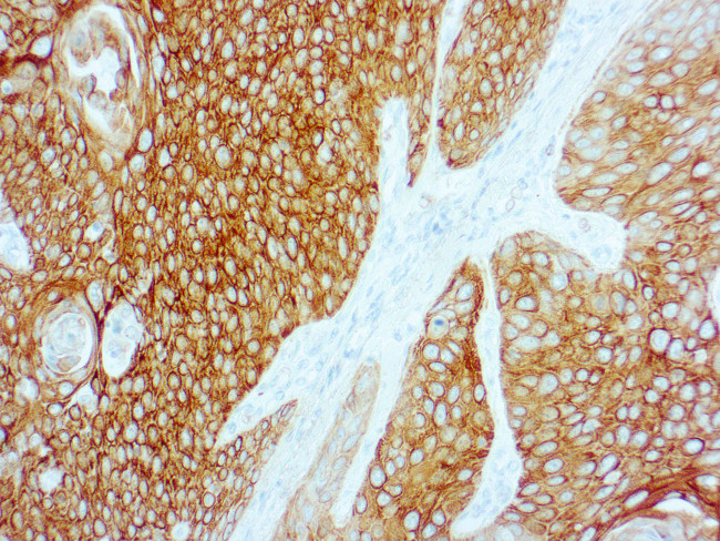 Cytokeratin 5/6 Antibody in Immunohistochemistry (Paraffin) (IHC (P))