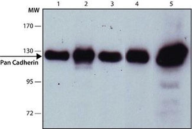 N-cadherin Antibody in Western Blot (WB)