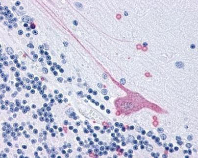 Chymotrypsin Antibody in Immunohistochemistry (IHC)