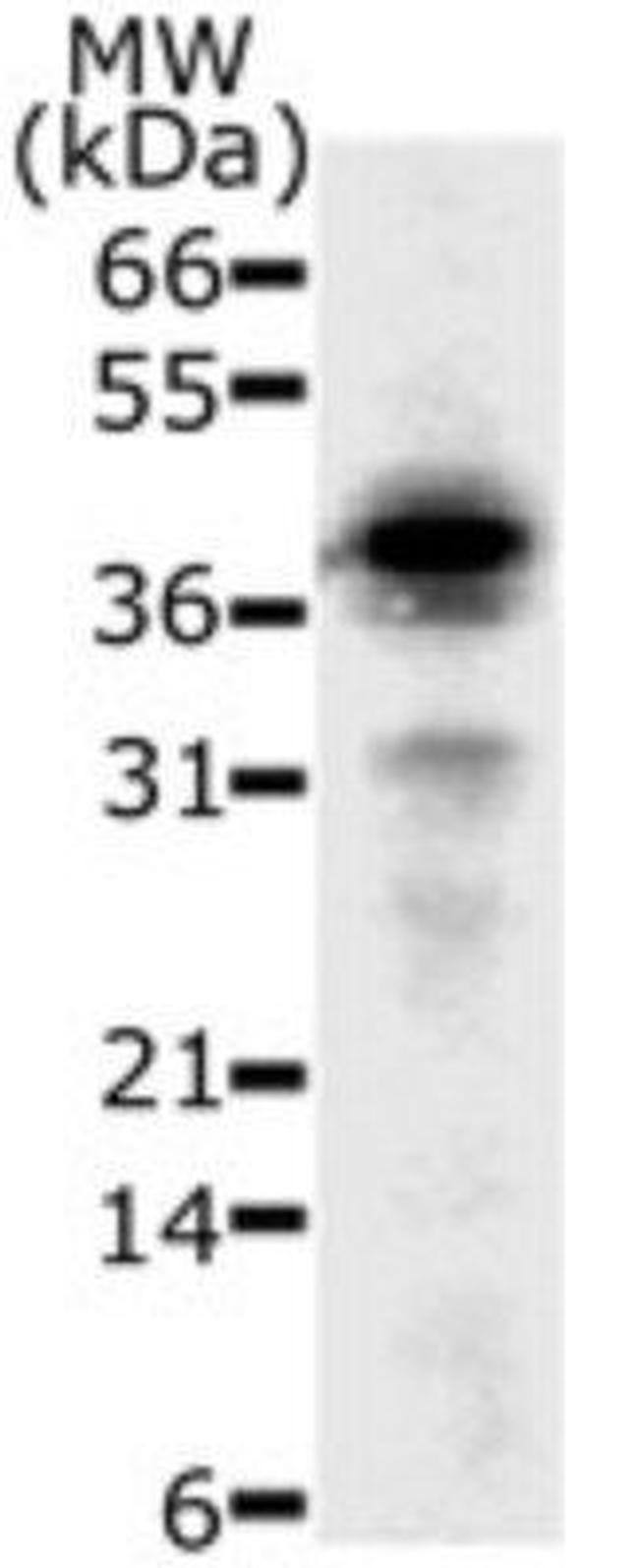 DFFB Antibody in Western Blot (WB)