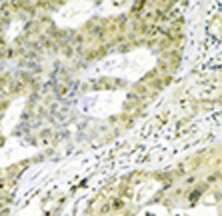 HSPA9 Antibody in Immunohistochemistry (IHC)