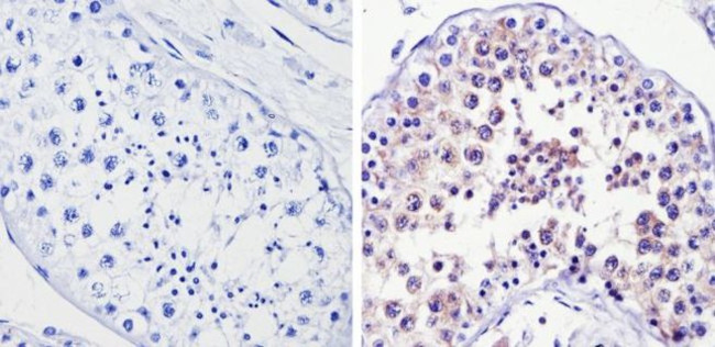 DIABLO Antibody in Immunohistochemistry (Paraffin) (IHC (P))