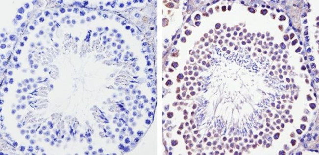 DIABLO Antibody in Immunohistochemistry (Paraffin) (IHC (P))