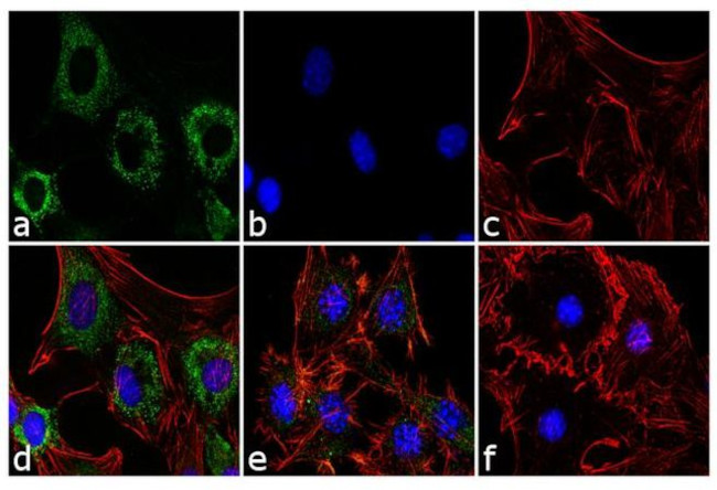 Adiponectin Antibody in Immunocytochemistry (ICC/IF)