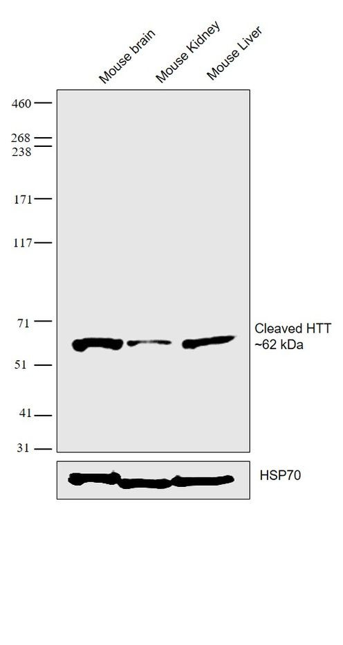 Huntingtin Antibody