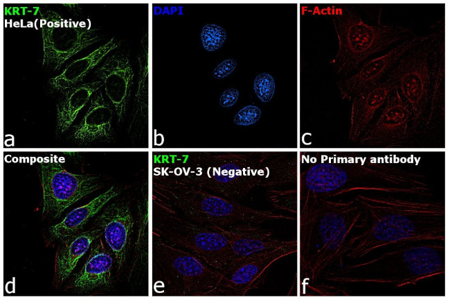 Cytokeratin 7 Antibody