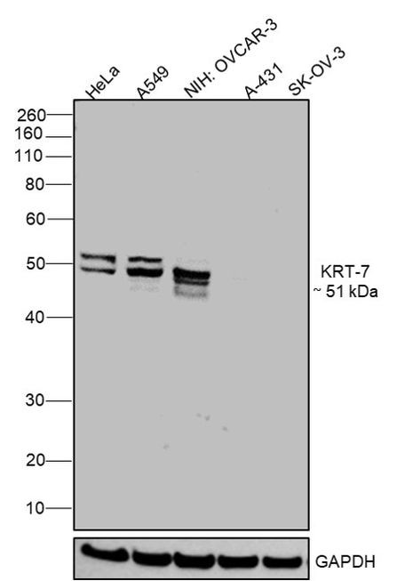 Cytokeratin 7 Antibody