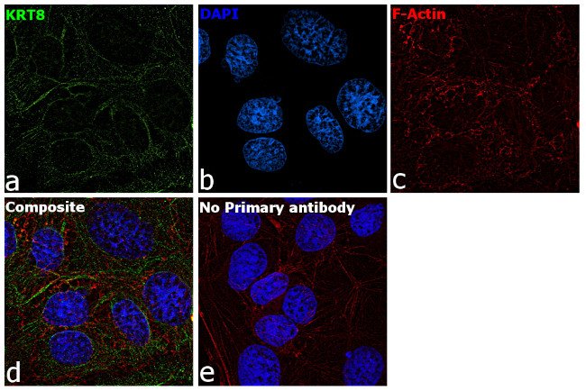 Cytokeratin 8 Antibody in Immunocytochemistry (ICC/IF)